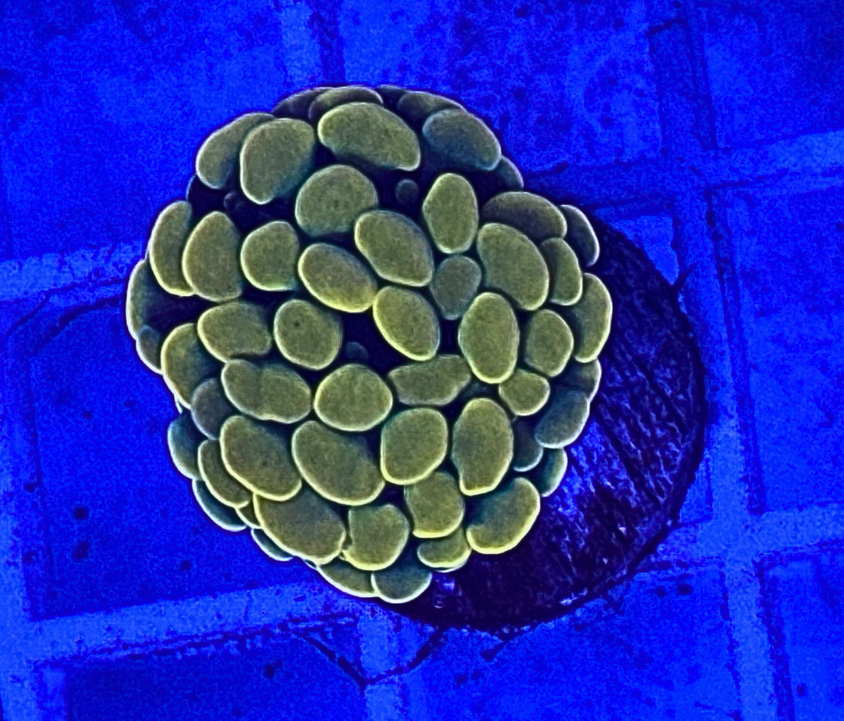 Bright Yellow Hammer Coral